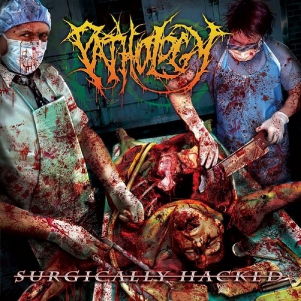 Surgically Hacked - album