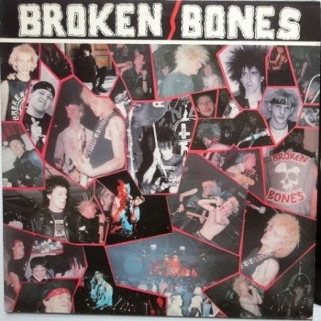 Album Broken Bones - Never Say Die