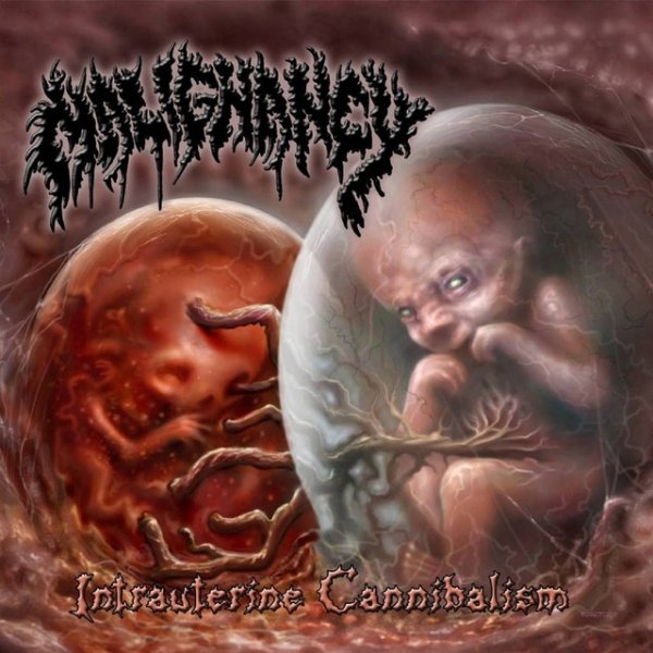 Album Malignancy - Intrauterine Cannibalism
